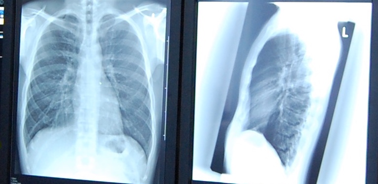Röntgenbild Röntgenpraxis Berlin